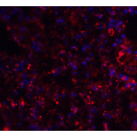 AXIN2 / Axin 2 Antibody - Immunofluorescence of AXIN2 in mouse lung tissue with AXIN2 antibody at 20 µg/mL.