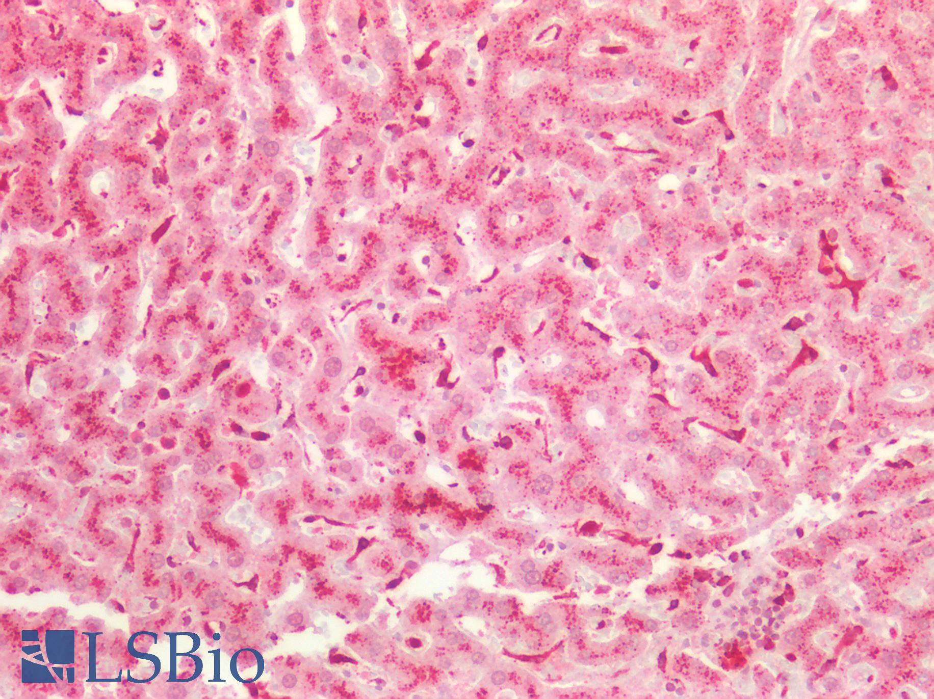 AXIN2 / Axin 2 Antibody - Human Liver: Formalin-Fixed, Paraffin-Embedded (FFPE)