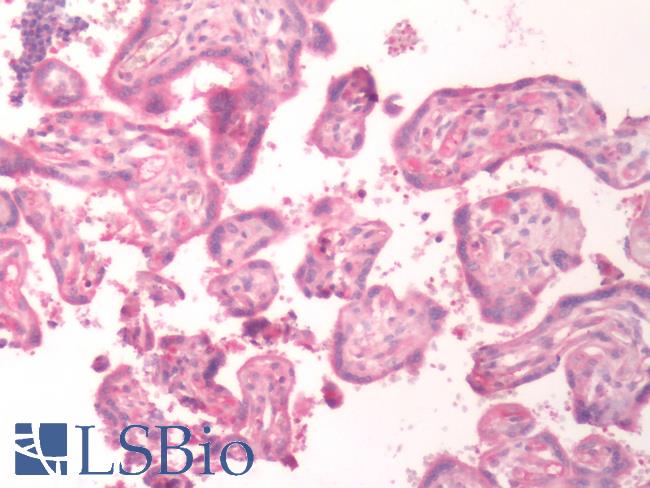B1R / BDKRB1 Antibody - Human Placenta: Formalin-Fixed, Paraffin-Embedded (FFPE)