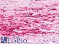 B1R / BDKRB1 Antibody - Anti-B1R / BDKRB1 antibody IHC of human artery, smooth muscle, atherosclerosis. Immunohistochemistry of formalin-fixed, paraffin-embedded tissue after heat-induced antigen retrieval. Antibody dilution 5 ug/ml.