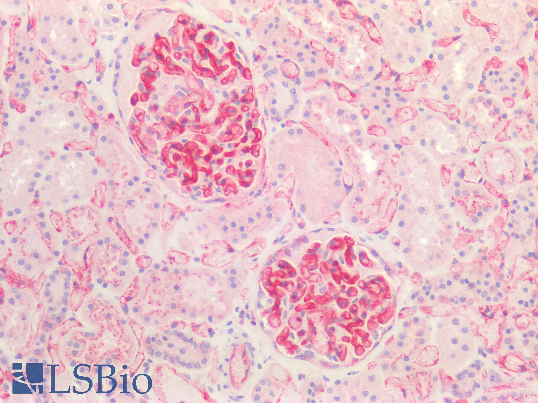 B2M / Beta 2 Microglobulin Antibody - Human Kidney: Formalin-Fixed, Paraffin-Embedded (FFPE)