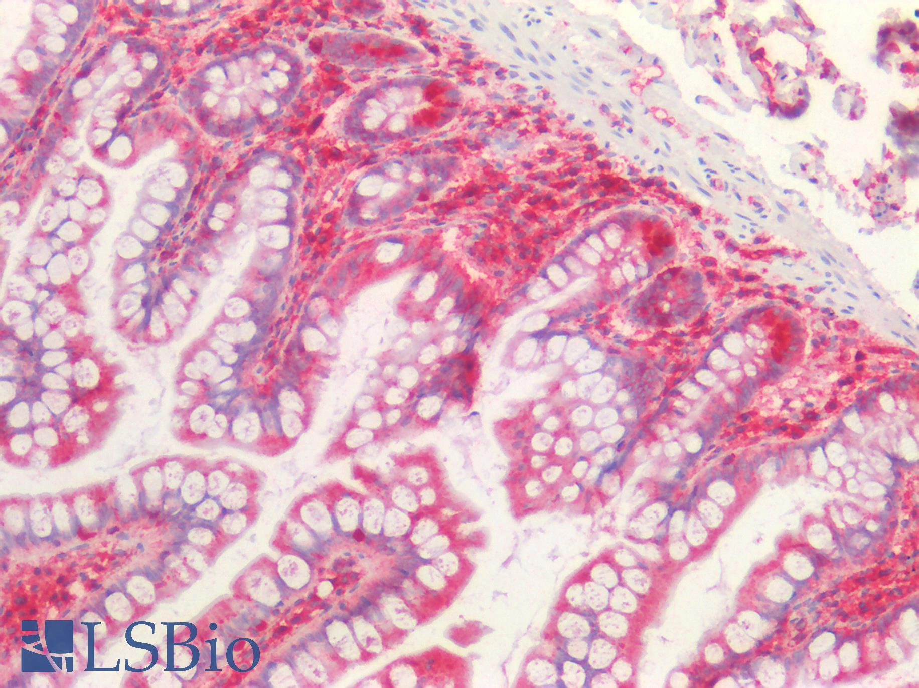 B2M / Beta 2 Microglobulin Antibody - Human Small Intestine: Formalin-Fixed, Paraffin-Embedded (FFPE)