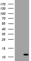 B2M / Beta 2 Microglobulin Antibody - HEK293T cells were transfected with the pCMV6-ENTRY control (Left lane) or pCMV6-ENTRY B2M (Right lane) cDNA for 48 hrs and lysed. Equivalent amounts of cell lysates (5 ug per lane) were separated by SDS-PAGE and immunoblotted with anti-B2M.