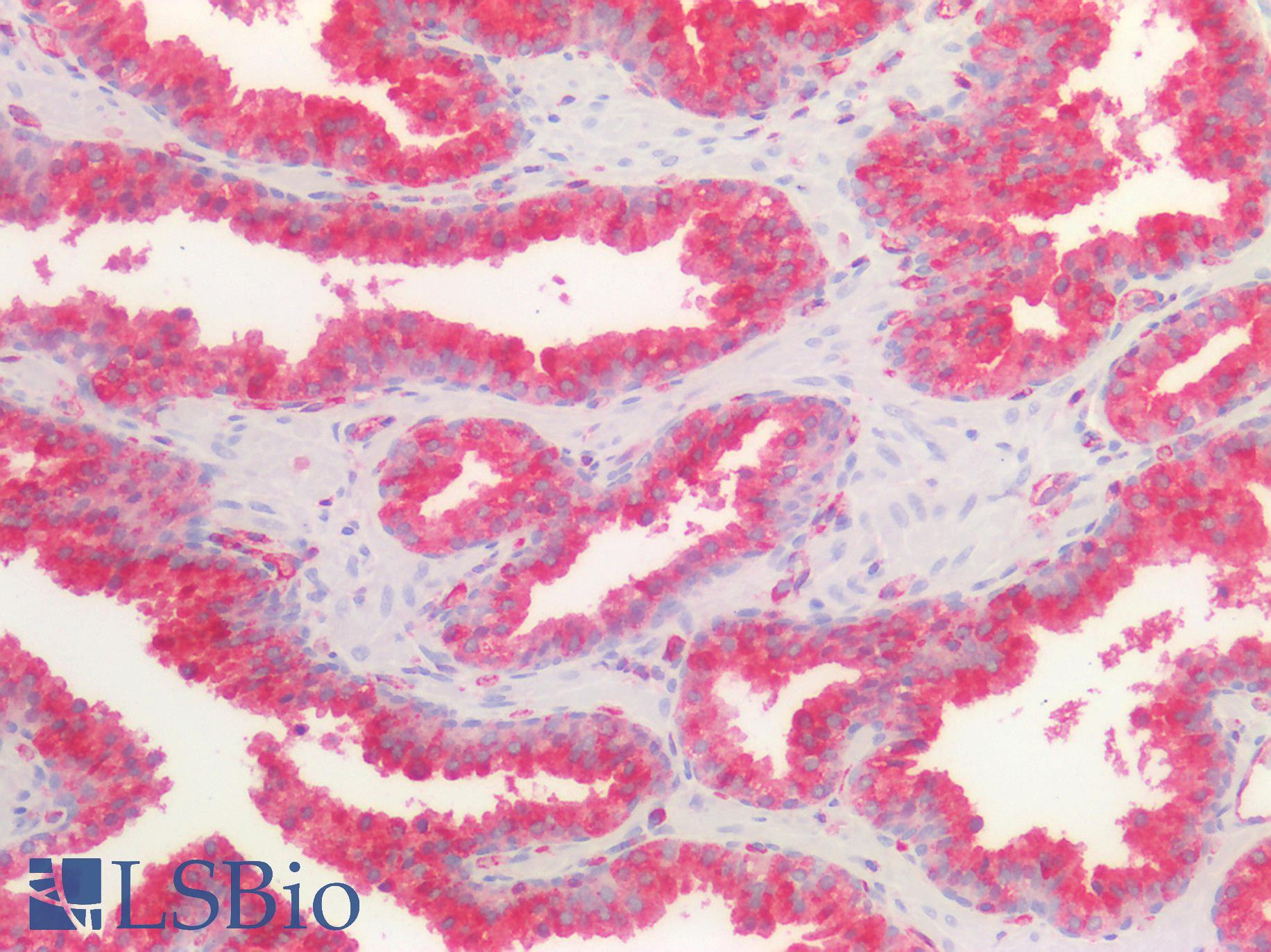 B2M / Beta 2 Microglobulin Antibody - Human Prostate: Formalin-Fixed, Paraffin-Embedded (FFPE)