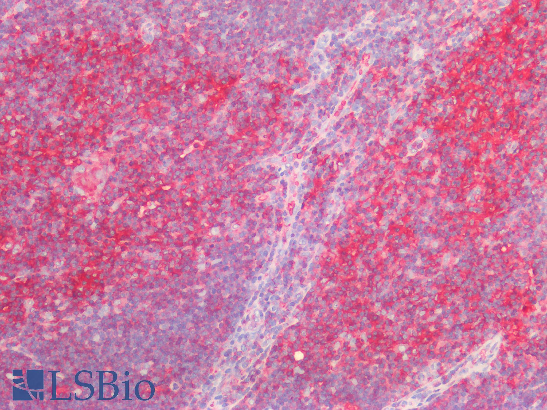 B2M / Beta 2 Microglobulin Antibody - Human Thymus: Formalin-Fixed, Paraffin-Embedded (FFPE)