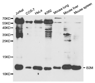 B2M / Beta 2 Microglobulin Antibody - Western blot analysis of extracts of various cell lines, using B2M antibody at 1:1000 dilution. The secondary antibody used was an HRP Goat Anti-Rabbit IgG (H+L) at 1:10000 dilution. Lysates were loaded 25ug per lane and 3% nonfat dry milk in TBST was used for blocking.