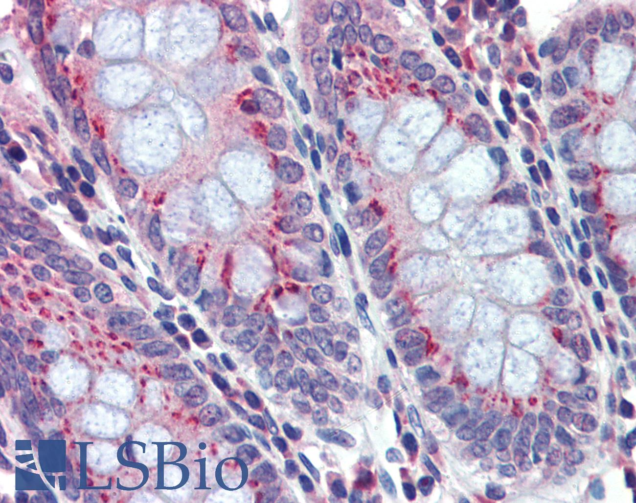 BACE2 Antibody - Anti-BACE2 antibody IHC of human colon. Immunohistochemistry of formalin-fixed, paraffin-embedded tissue after heat-induced antigen retrieval. Antibody concentration 5 ug/ml.
