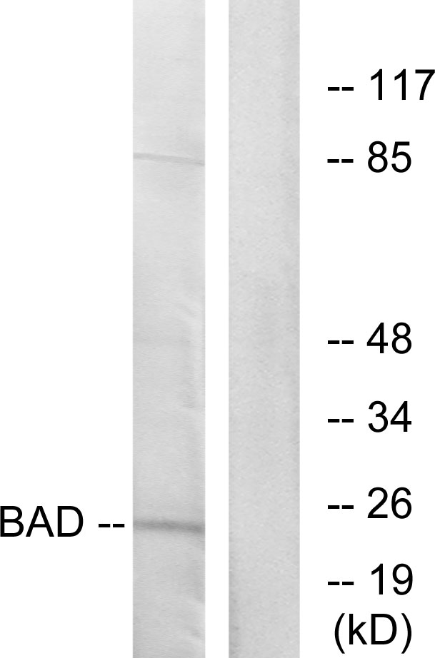 BAD Antibody - Western blot analysis of lysates from 293 cells, treated with Forskolin, using BAD Antibody. The lane on the right is blocked with the synthesized peptide.