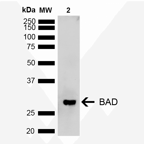 BAD Antibody - Western blot analysis of Rat Kidney showing detection of ~18.3 kDa BAD protein using Rabbit Anti-BAD Polyclonal Antibody. Lane 1: Molecular Weight Ladder (MW). Lane 2: Rat Kidney. Load: 15 µg. Block: 5% Skim Milk in 1X TBST. Primary Antibody: Rabbit Anti-BAD Polyclonal Antibody  at 1:1000 for 2 hours at RT. Secondary Antibody: Goat Anti-Rabbit IgG: HRP at 1:3000 for 1 hour at RT. Color Development: ECL solution for 5 min at RT. Predicted/Observed Size: ~18.3 kDa. Other Band(s): 28 kDa (PTM).