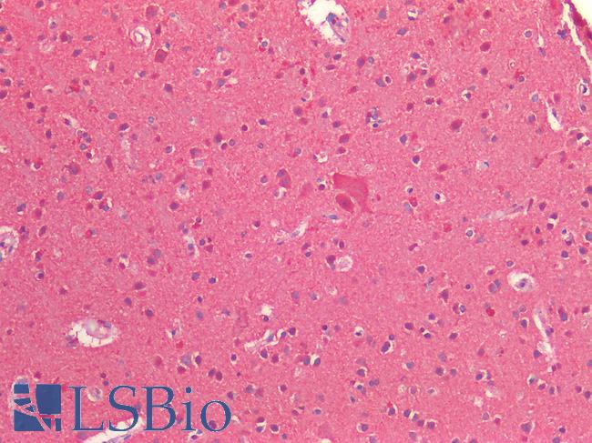 BAD Antibody - Human Brain, Cortex: Formalin-Fixed, Paraffin-Embedded (FFPE)