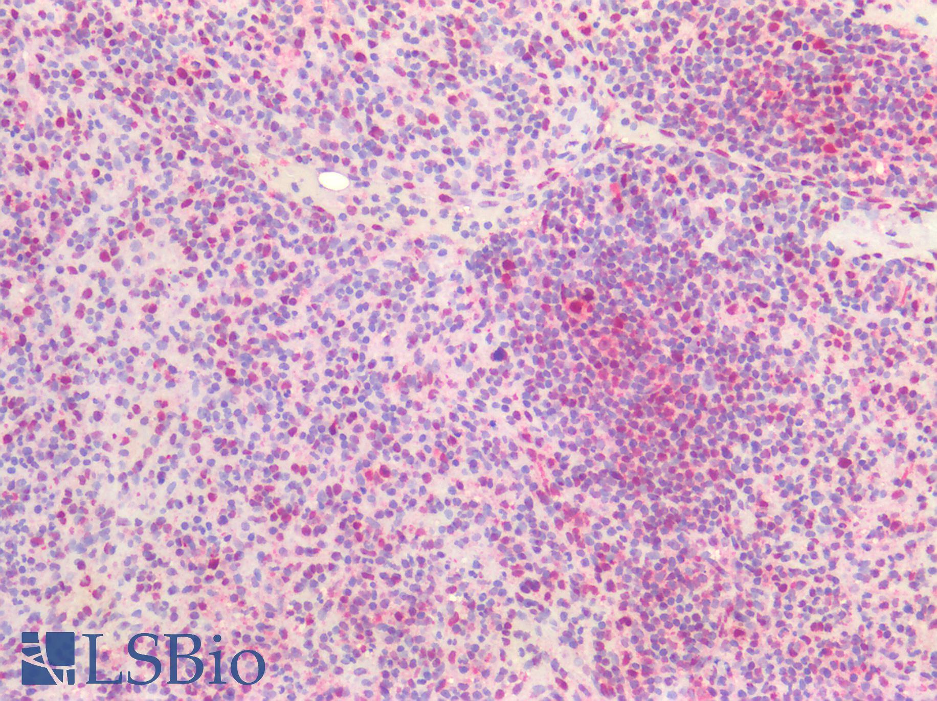 BAD Antibody - Human Spleen: Formalin-Fixed, Paraffin-Embedded (FFPE)