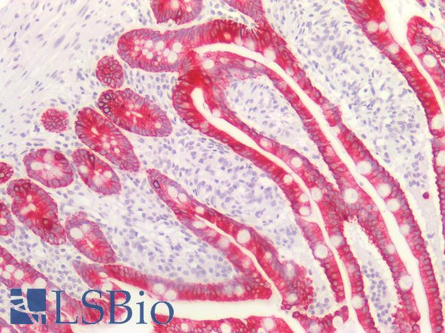 Basic Cytokeratin AE3 Antibody - Human Small Intestine: Formalin-Fixed, Paraffin-Embedded (FFPE)