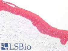 Basic Cytokeratin AE3 Antibody - Human Skin: Formalin-Fixed, Paraffin-Embedded (FFPE)