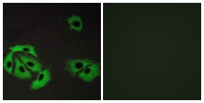 BAX Antibody - Immunofluorescence of A549 cells, using BAX Antibody. The picture on the right is treated with the synthesized peptide.