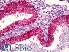 BAX Antibody - Anti-BAX antibody IHC of human uterus, endometrium. Immunohistochemistry of formalin-fixed, paraffin-embedded tissue after heat-induced antigen retrieval. Antibody dilution 1:100.