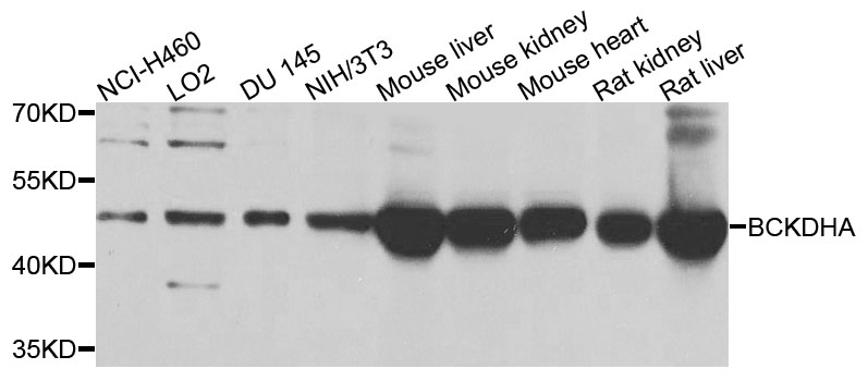 BCKDHA / BCKDE1A Antibody - Western blot analysis of extracts of various cells.