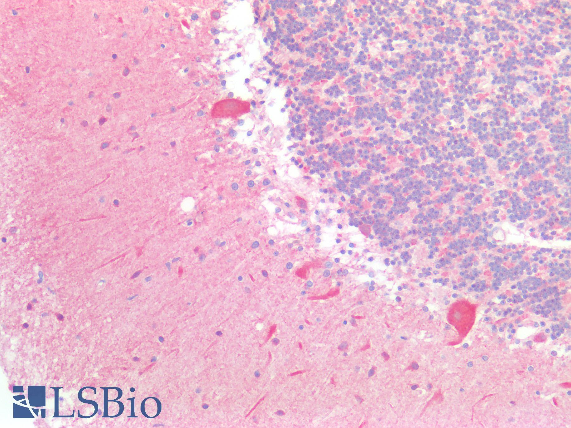 BCKDHA / BCKDE1A Antibody - Human Brain, Cerebellum: Formalin-Fixed, Paraffin-Embedded (FFPE)