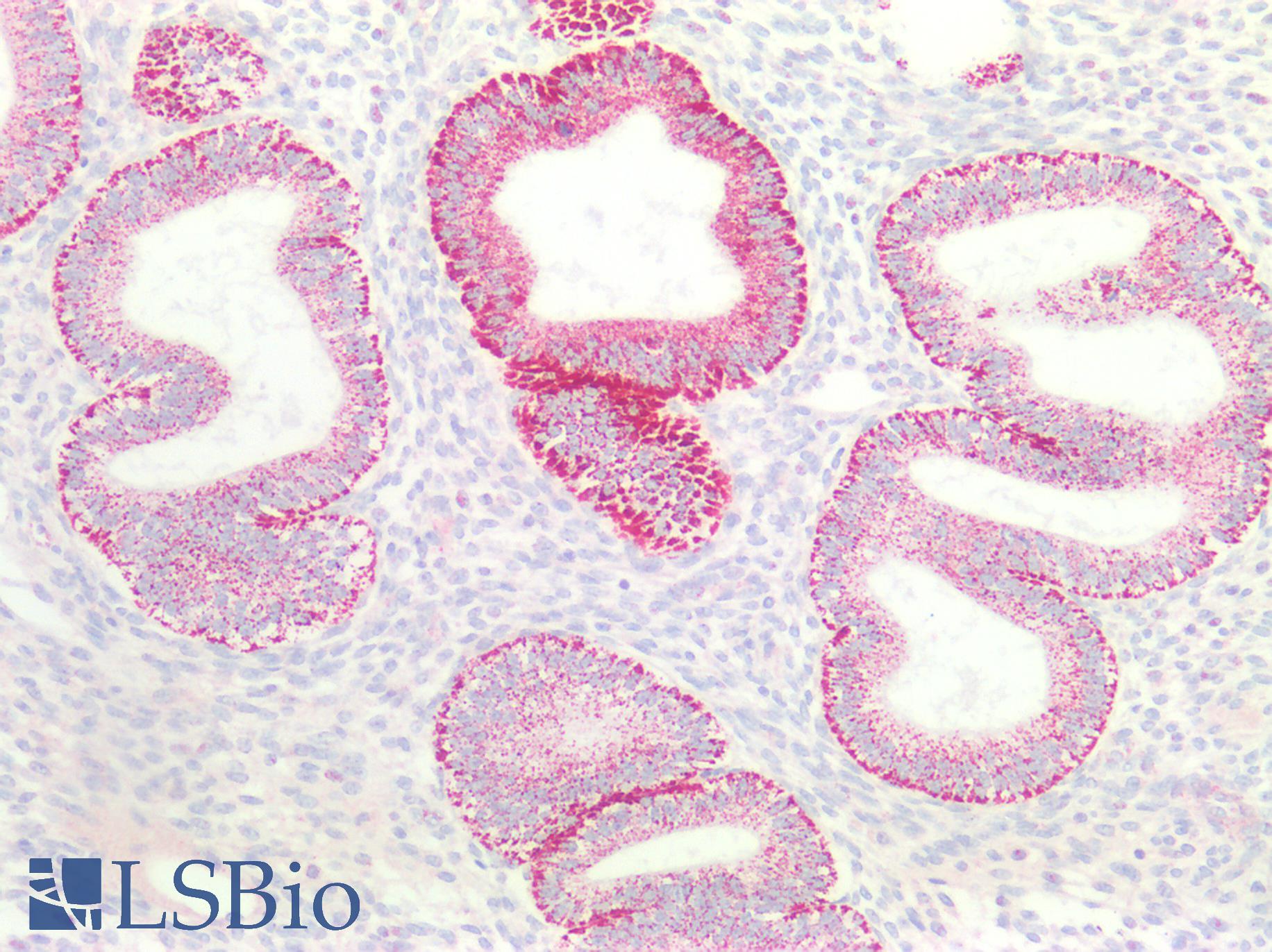BCKDHA / BCKDE1A Antibody - Human Uterus: Formalin-Fixed, Paraffin-Embedded (FFPE)