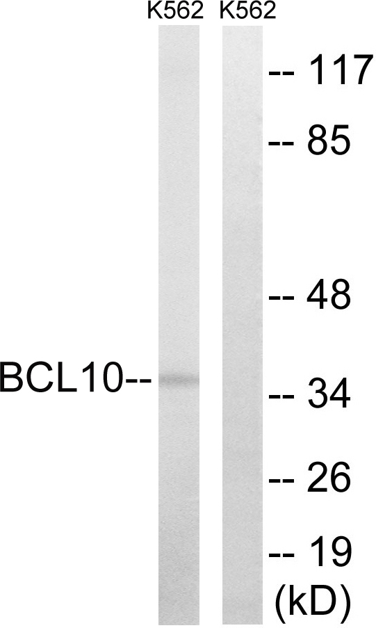 BCL10 / BCL-10 Antibody - Western blot analysis of lysates from K562 cells, using BCL10 Antibody. The lane on the right is blocked with the synthesized peptide.