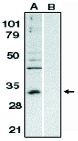 BCL10 / BCL-10 Antibody - Western blot of anti-Bcl-10 (NT) antibody at 1 ug/ml on Raji whole cell lysate in the absence (A) and presence (B) of blocking peptide.
