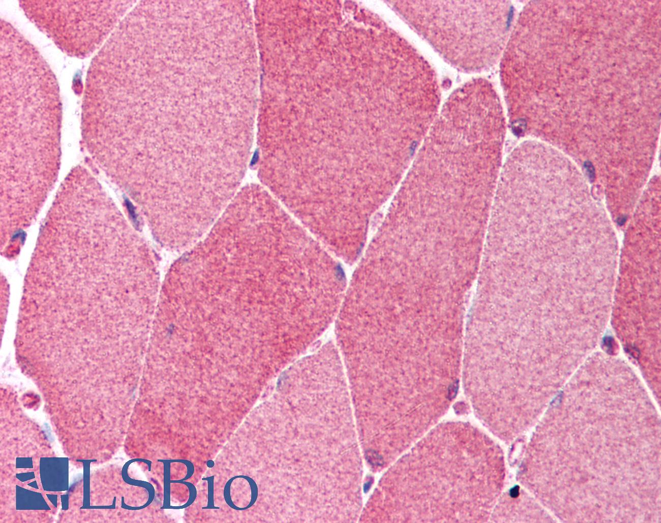 BCL10 / BCL-10 Antibody - Anti-BCL10 antibody IHC of human skeletal muscle. Immunohistochemistry of formalin-fixed, paraffin-embedded tissue after heat-induced antigen retrieval. Antibody concentration 10 ug/ml.