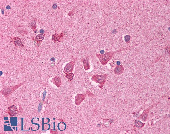 BCL10 / BCL-10 Antibody - Anti-BCL10 antibody IHC of human brain, cortex. Immunohistochemistry of formalin-fixed, paraffin-embedded tissue after heat-induced antigen retrieval. Antibody concentration 10 ug/ml.