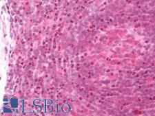 BCL10 / BCL-10 Antibody - Human Tonsil: Formalin-Fixed, Paraffin-Embedded (FFPE).  This image was taken for the unconjugated form of this product. Other forms have not been tested.