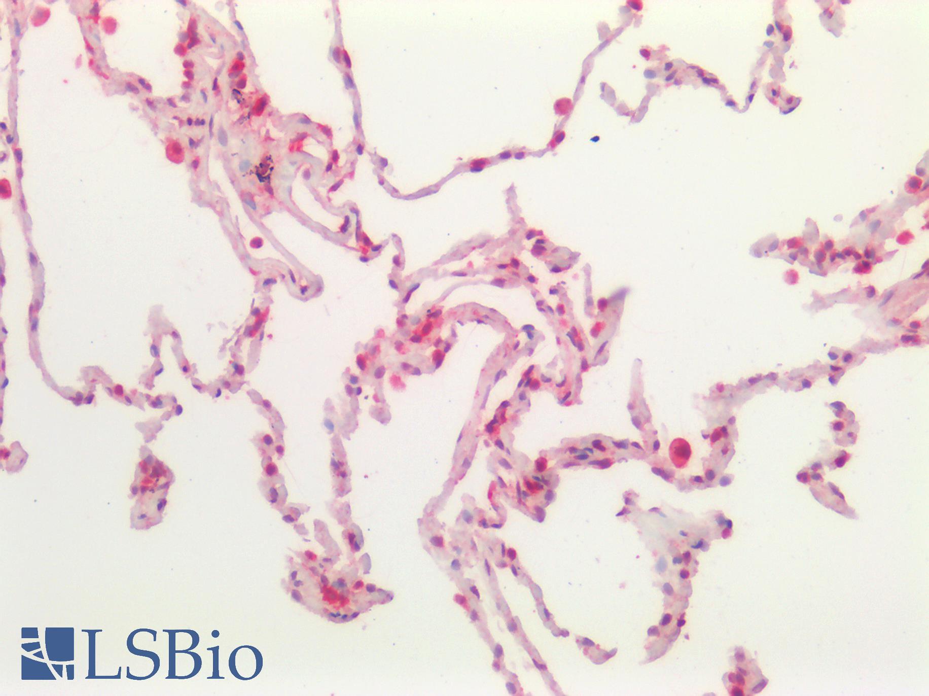 BCL10 / BCL-10 Antibody - Human Lung: Formalin-Fixed, Paraffin-Embedded (FFPE)