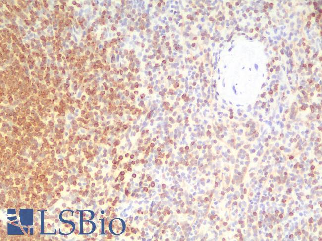 BCL2 / Bcl-2 Antibody - Human Spleen: Formalin-Fixed, Paraffin-Embedded (FFPE)