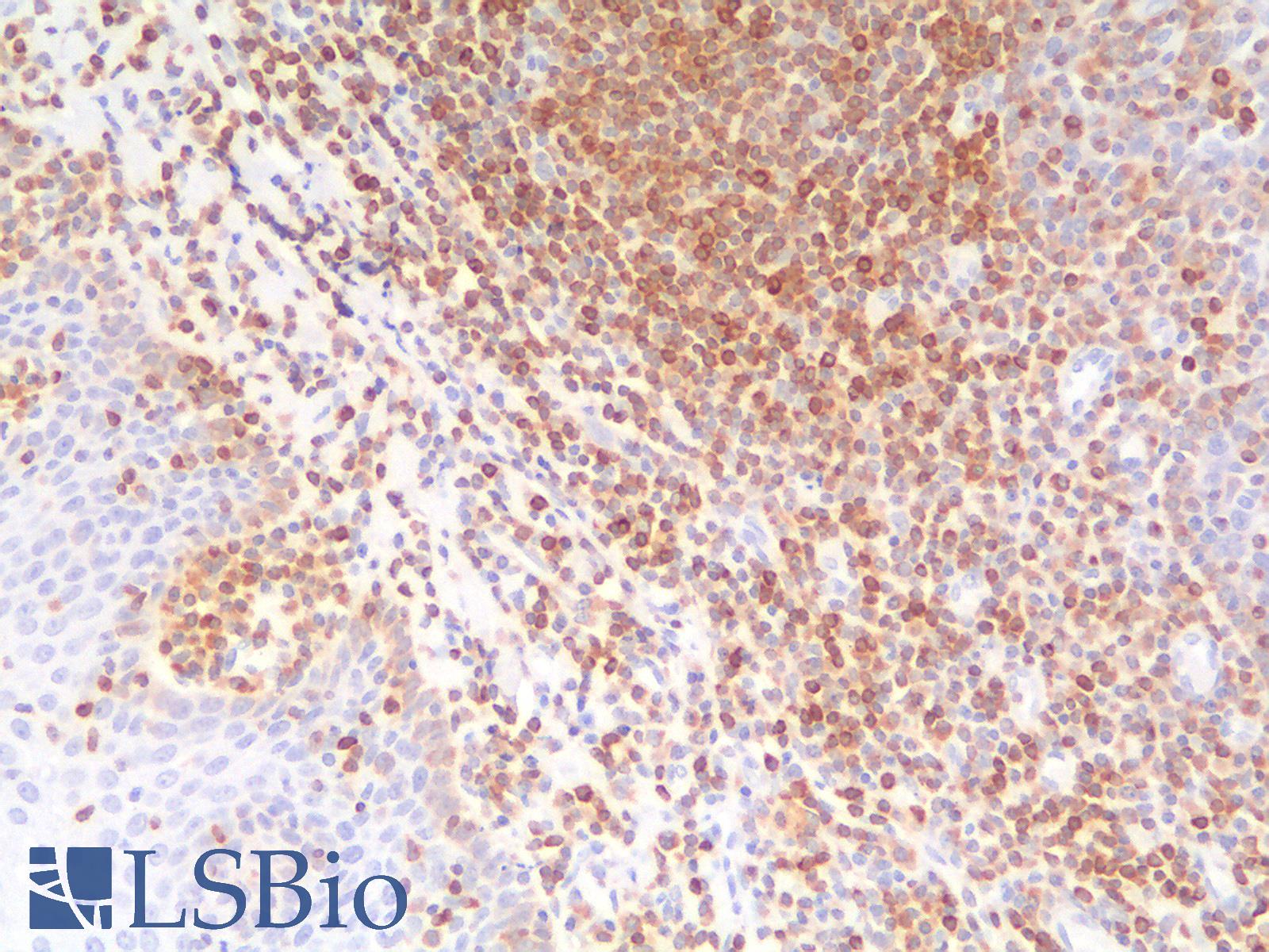 BCL2 / Bcl-2 Antibody - Human Tonsil: Formalin-Fixed, Paraffin-Embedded (FFPE)