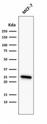 BCL2 / Bcl-2 Antibody - Western Blot Analysis of MCF-7 Cell lysate using Bcl-2 Mouse Recombinant Monoclonal Antibody (rBCL2/782).