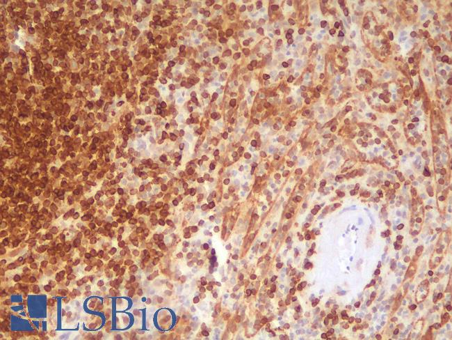 BCL2 / Bcl-2 Antibody - Human Spleen: Formalin-Fixed, Paraffin-Embedded (FFPE)