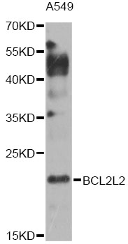 BCL2L2 / Bcl-w Antibody - Western blot analysis of extracts of A549 cells, using BCL2L2 antibody at 1:1000 dilution. The secondary antibody used was an HRP Goat Anti-Rabbit IgG (H+L) at 1:10000 dilution. Lysates were loaded 25ug per lane and 3% nonfat dry milk in TBST was used for blocking. An ECL Kit was used for detection and the exposure time was 30s.