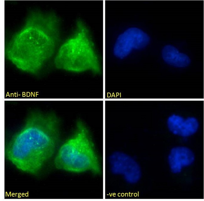 BDNF Antibody - BDNF antibody immunofluorescence analysis of paraformaldehyde fixed U251 cells, permeabilized with 0.15% Triton. Primary incubation 1hr (10ug/ml) followed by Alexa Fluor 488 secondary antibody (2ug/ml), showing vesicle staining. The nuclear stain is DAPI (blue).