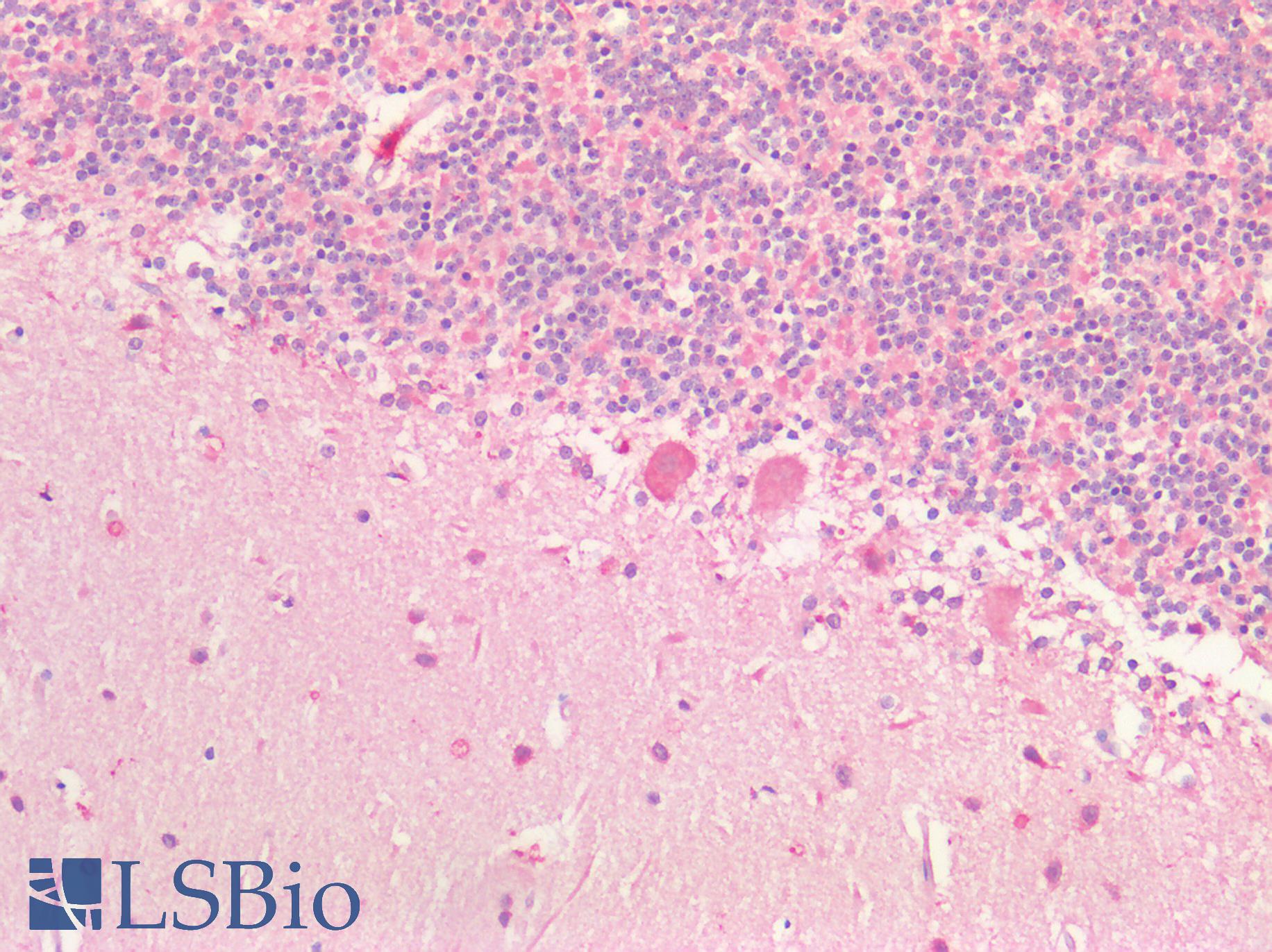 BDNF Antibody - Human Brain, Cerebellum: Formalin-Fixed, Paraffin-Embedded (FFPE)