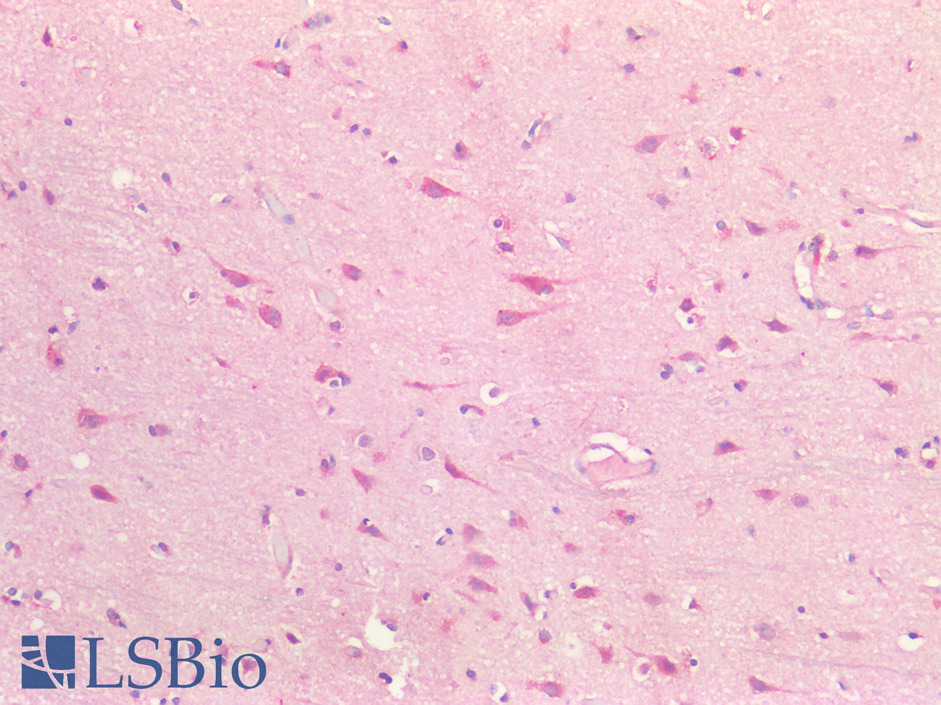 BDNF Antibody - Human Brain, Cortex: Formalin-Fixed, Paraffin-Embedded (FFPE)