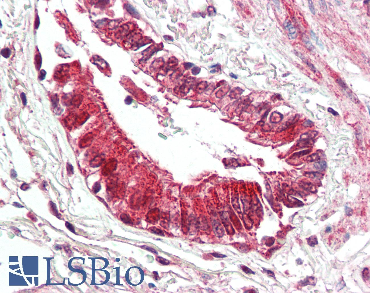 BECN1 / Beclin-1 Antibody - Anti-BECN1 / Beclin-1 antibody IHC of human lung, respiratory epithelium. Immunohistochemistry of formalin-fixed, paraffin-embedded tissue after heat-induced antigen retrieval. Antibody concentration 5 ug/ml.