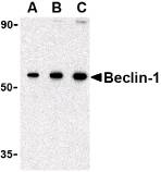 BECN1 / Beclin-1 Antibody - Western blot of Beclin-1 in 293 cell lysate with Beclin-1 antibody at (A) 0.5, (B) 1 and (C) 2 ug/ml.