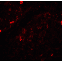 BECN1 / Beclin-1 Antibody - Immunofluorescence of Beclin-1 in human brain tissue with Beclin-1 antibody at 20 µg/ml.