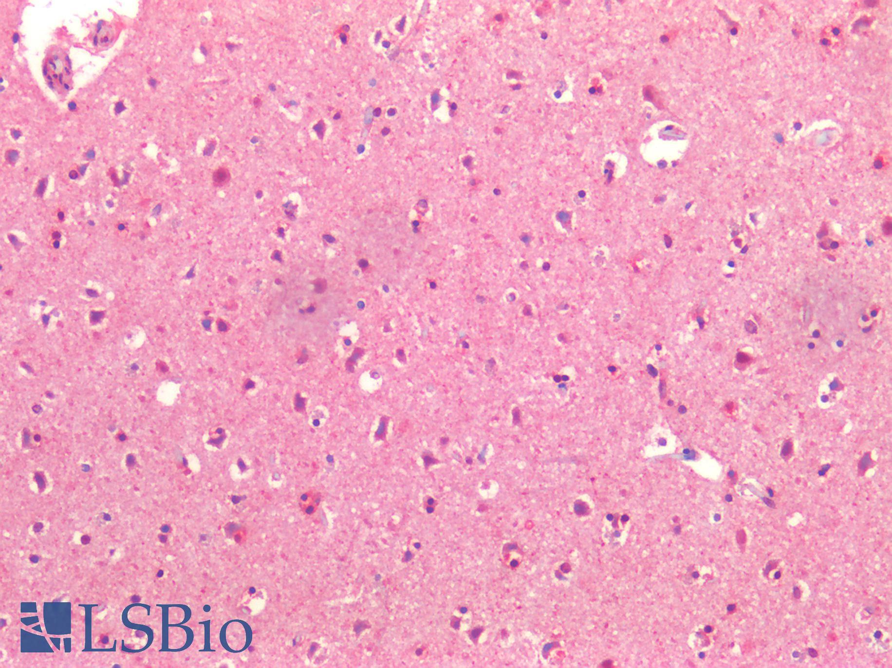 BECN1 / Beclin-1 Antibody - Human Brain, Cortex: Formalin-Fixed, Paraffin-Embedded (FFPE)