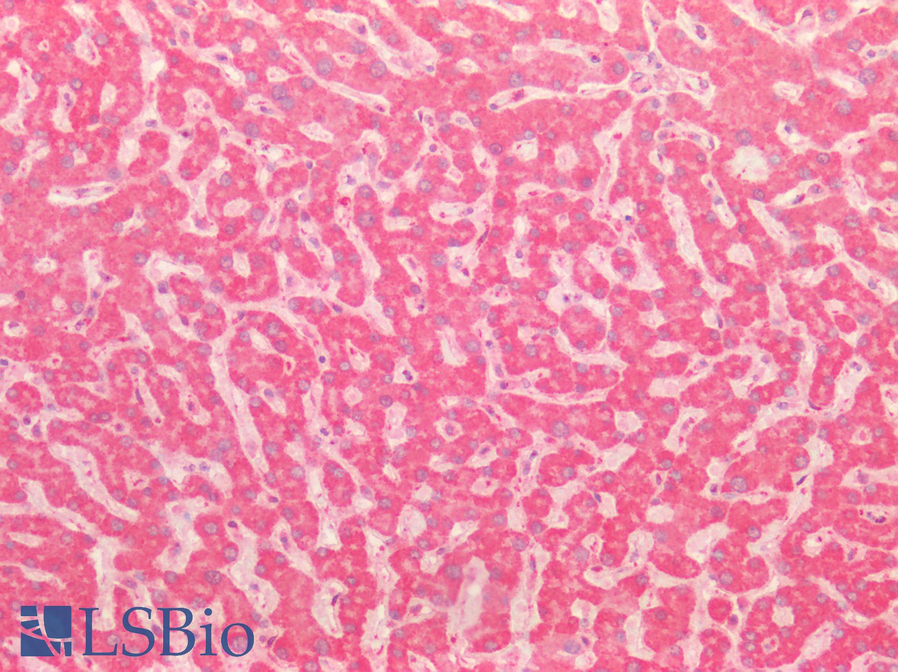 BECN1 / Beclin-1 Antibody - Human Liver: Formalin-Fixed, Paraffin-Embedded (FFPE)