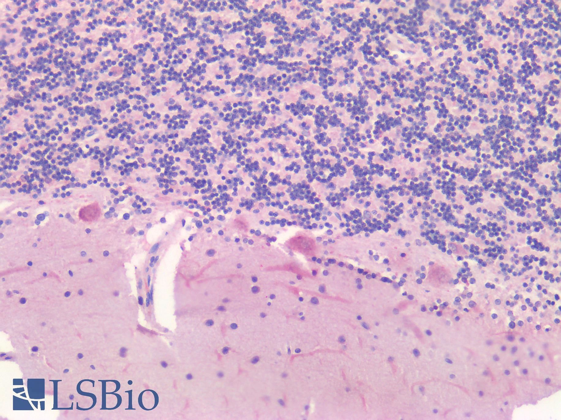 BIRC5 / Survivin Antibody - Human Brain, Cerebellum: Formalin-Fixed, Paraffin-Embedded (FFPE)