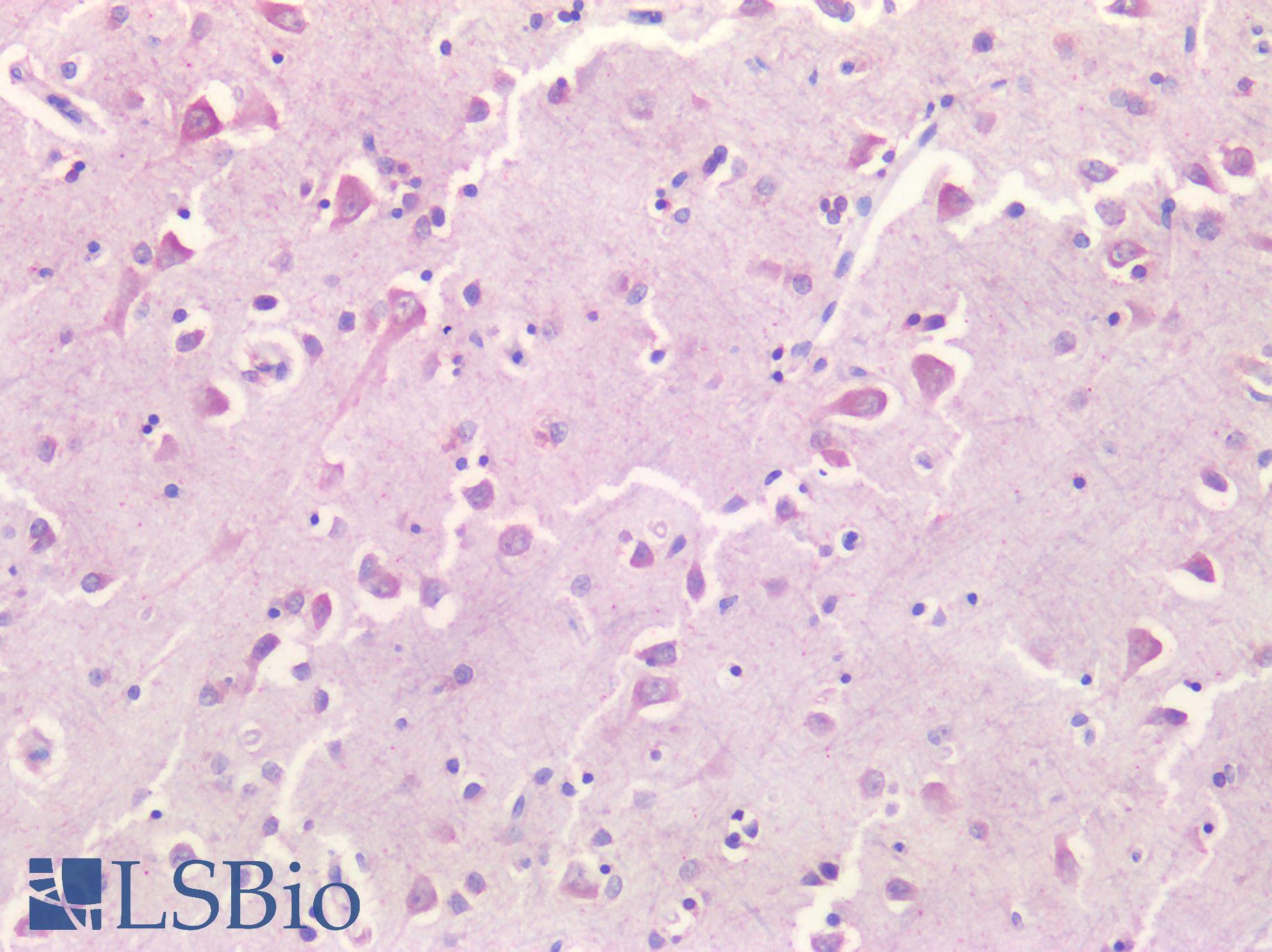BIRC5 / Survivin Antibody - Human Brain, Cortex: Formalin-Fixed, Paraffin-Embedded (FFPE)