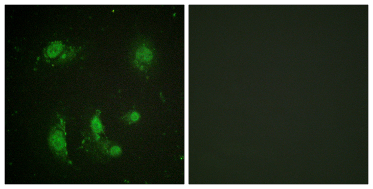 BIRC5 / Survivin Antibody - Immunofluorescence analysis of HeLa cells, using Survivin Antibody. The picture on the right is blocked with the synthesized peptide.