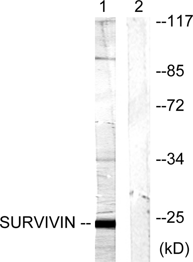 BIRC5 / Survivin Antibody - Western blot analysis of lysates from mouse lung, using Survivin Antibody. The lane on the right is blocked with the synthesized peptide.