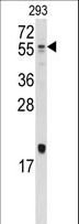 BMP10 Antibody - Western blot of anti-Bmp10 Antibody in 293 cell line lysates (35 ug/lane). Bmp10(arrow) was detected using the purified antibody.