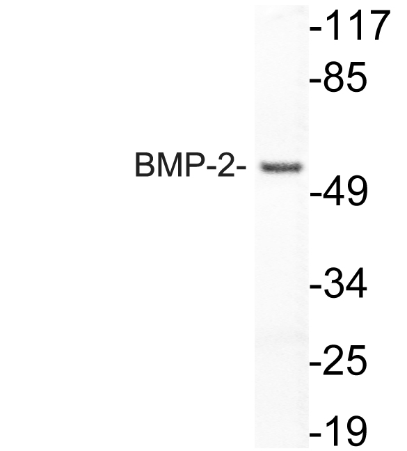 BMP2 Antibody - Western blot analysis of lysate from HUVECcells, using BMP-2 antibody.