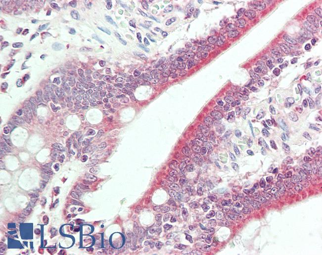 BMP6 Antibody - Anti-BMP6 antibody IHC staining of human small intestine. Immunohistochemistry of formalin-fixed, paraffin-embedded tissue after heat-induced antigen retrieval. Antibody concentration 20 ug/ml. This image was taken for the unconjugated form of this product. Other forms have not been tested.
