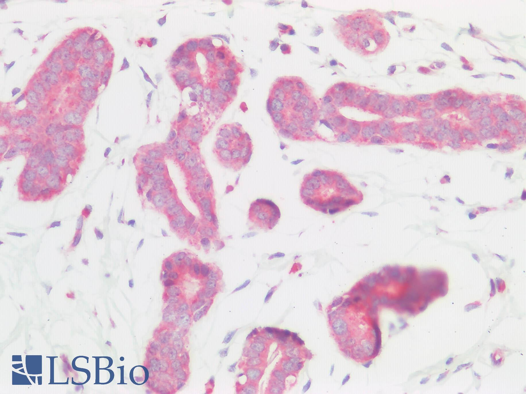 BMP6 Antibody - Human Breast: Formalin-Fixed, Paraffin-Embedded (FFPE)