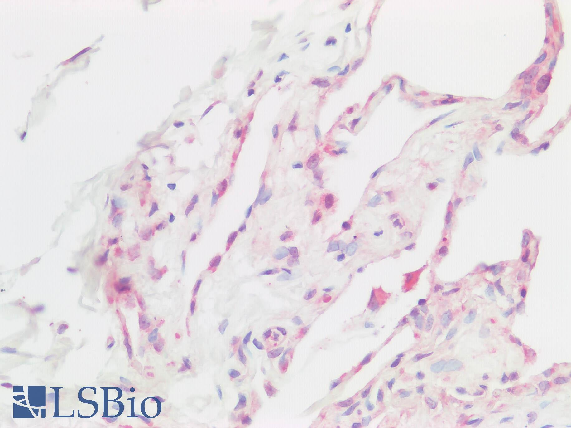 BMP6 Antibody - Human Lung: Formalin-Fixed, Paraffin-Embedded (FFPE)